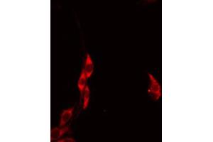 Image no. 3 for anti-Holocytochrome C Synthase (HCCS) (Internal Region) antibody (ABIN6257604)