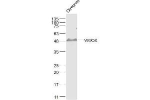 Image no. 2 for anti-WW Domain Containing Oxidoreductase (WWOX) (AA 5-100) antibody (ABIN670551)