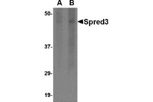 Image no. 1 for anti-Sprouty-Related, EVH1 Domain Containing 3 (SPRED3) (Middle Region) antibody (ABIN1031104)