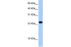 Image no. 1 for anti-Eukaryotic Translation Initiation Factor 4E Family Member 3 (EIF4E3) (Middle Region) antibody (ABIN633584)
