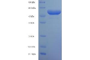 Image no. 1 for phosphoribosyl Pyrophosphate Synthetase 1 (PRPS1) (AA 2-318) protein (His-SUMO Tag) (ABIN5710157)