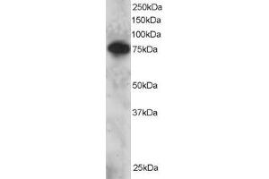 Image no. 1 for anti-SET Domain and Mariner Transposase Fusion Gene (SETMAR) (C-Term) antibody (ABIN184884)