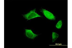 Immunofluorescence of purified MaxPab antibody to URP2 on HeLa cell.