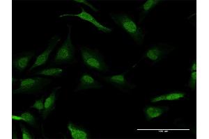 Immunofluorescence of purified MaxPab antibody to PPM1A on HeLa cell.