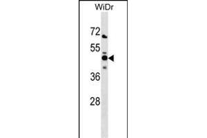 NMI Antibody (N-term) (ABIN1538906 and ABIN2838348) western blot analysis in WiDr cell line lysates (35 μg/lane).