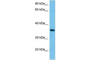Image no. 4 for anti-Nuclear Transcription Factor Y, gamma (NFYC) (C-Term) antibody (ABIN2780913)