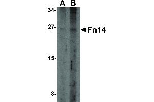 anti-Tumor Necrosis Factor Receptor Superfamily, Member 12A (TNFRSF12A) antibody