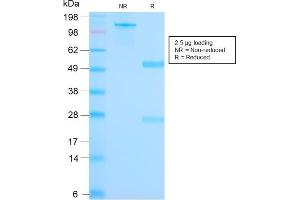 Image no. 4 for anti-Secretoglobin, Family 2A, Member 2 (SCGB2A2) antibody (ABIN6940039)