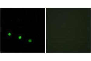 Immunofluorescence analysis of HuvEc cells treated with EGF 200nM 5', using FosB (Phospho-Ser27) Antibody.