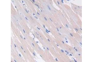 Image no. 2 for anti-Vascular Endothelial Growth Factor C (VEGFC) (AA 108-223) antibody (ABIN1078653)