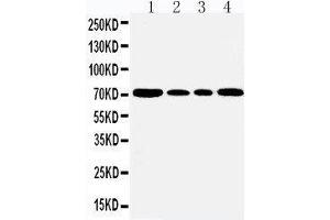 Image no. 2 for anti-Heat Shock 70kDa Protein 5 (Glucose-Regulated Protein, 78kDa) (HSPA5) (AA 603-617), (C-Term) antibody (ABIN3044191)