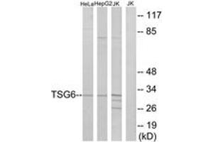 Image no. 1 for anti-Tumor Necrosis Factor-Inducible Protein 6 (TNFAIP6) (AA 21-70) antibody (ABIN1533814)