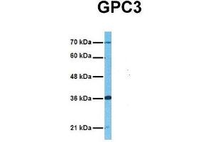 Host:  Rabbit  Target Name:  GPC3  Sample Tissue:  Human Adult Placenta  Antibody Dilution:  1.
