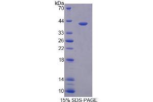 Image no. 1 for Thiosulfate Sulfurtransferase (Rhodanese) (TST) (AA 2-297) protein (His tag) (ABIN6239137)