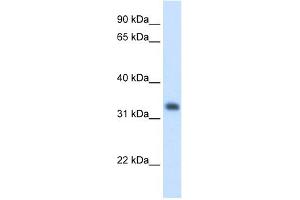 Image no. 1 for anti-3-Hydroxymethyl-3-Methylglutaryl-CoA Lyase (HMGCL) (N-Term) antibody (ABIN2776938)