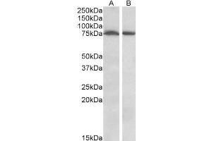 Image no. 3 for anti-serine threonine Kinase 39 (STK39) (Internal Region) antibody (ABIN570996)