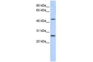 Image no. 1 for anti-PRAME Family Member 10 (PRAMEF10) (AA 396-445) antibody (ABIN6741262)