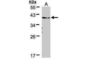 Image no. 1 for anti-Transmembrane Protein 59 (TMEM59) (Center) antibody (ABIN2855840)