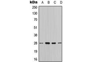 Image no. 3 for anti-14-3-3 theta (YWHAQ) (Center) antibody (ABIN2705348)
