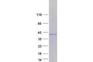 Image no. 1 for T-Cell Leukemia Homeobox 3 (TLX3) protein (Myc-DYKDDDDK Tag) (ABIN2733825)