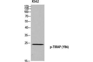 Image no. 1 for anti-Toll-Interleukin 1 Receptor (TIR) Domain Containing Adaptor Protein (TIRAP) (pTyr86) antibody (ABIN3182983)
