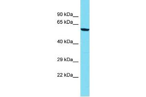 Image no. 1 for anti-Zinc Finger, CCHC Domain Containing 8 (ZCCHC8) (C-Term) antibody (ABIN2787008)