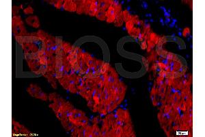 Image no. 1 for anti-Anoctamin 1, Calcium Activated Chloride Channel (ANO1) (AA 151-250) antibody (ABIN704216)
