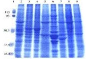 SDS-PAGE (SDS) image for Rat Normal Tissue Blot II (ABIN2455975)