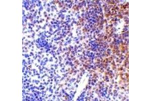 Immunohistochemistry (IHC) image for anti-Interferon Regulatory Factor 7 (IRF7) (Middle Region) antibody (ABIN1030964)