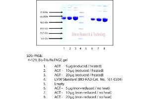 AGT Protein