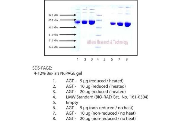 Angiotensinogen (serpin Peptidase Inhibitor, Clade A, Member 8) (AGT) protein