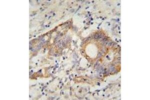 Image no. 2 for anti-HERV-H LTR-Associating 2 (HHLA2) (AA 65-95), (N-Term) antibody (ABIN952731)