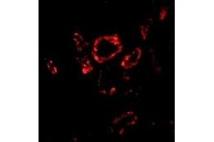 Immunofluorescence (IF) image for anti-SLUG (Middle Region 2) antibody (ABIN1031203)