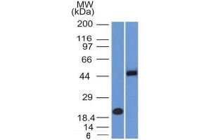 Image no. 1 for anti-Paired Box 8 (PAX8) (AA 60-261) antibody (ABIN6940924)