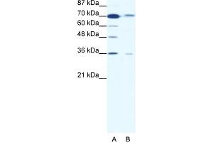 Image no. 1 for anti-SMAD Family Member 4 (SMAD4) (Middle Region) antibody (ABIN2779413)