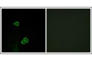 Image no. 1 for anti-Chemokine (C-X-C Motif) Receptor 7 (CXCR7) (C-Term) antibody (ABIN615865)