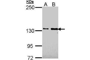 Image no. 1 for anti-Cell Adhesion Molecule-Related/down-Regulated By Oncogenes (CDON) (N-Term) antibody (ABIN2856103)