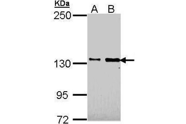 anti-Cell Adhesion Molecule-Related/down-Regulated By Oncogenes (CDON) (N-Term) antibody