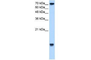 Image no. 3 for anti-Ubiquitin-Conjugating Enzyme E2N (UBE2N) (Middle Region) antibody (ABIN2777765)