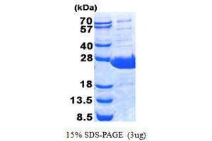 Image no. 1 for BPI Fold Containing Family A, Member 1 (BPIFA1) protein (ABIN2128205)