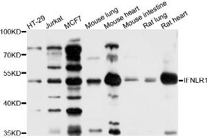 Image no. 2 for anti-Interleukin 28 Receptor, alpha (Interferon, lambda Receptor) (IL28RA) antibody (ABIN4904012)