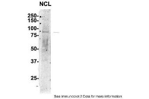 Image no. 2 for anti-Nucleolin (NCL) (C-Term) antibody (ABIN2778936)