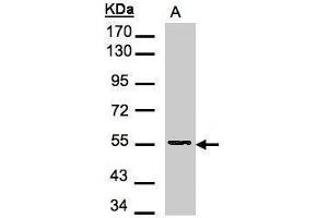 Image no. 2 for anti-Aspartyl Aminopeptidase (DNPEP) (Center) antibody (ABIN2855252)
