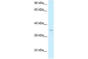 Image no. 1 for anti-SIX Homeobox 1 (SIX1) (N-Term) antibody (ABIN927733)