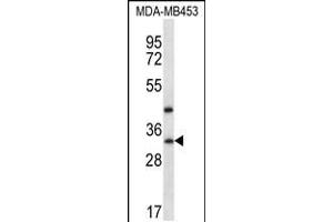 Image no. 1 for anti-TAF9B RNA Polymerase II, TATA Box Binding Protein (TBP)-Associated Factor, 31kDa (TAF9B) (AA 44-72), (N-Term) antibody (ABIN5537605)