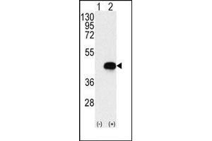 Image no. 2 for anti-Branched Chain Ketoacid Dehydrogenase Kinase (BCKDK) (Middle Region) antibody (ABIN359244)