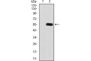 Image no. 2 for anti-Histone Deacetylase 9 (HDAC9) (AA 343-569) antibody (ABIN5867683)
