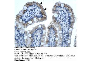 Image no. 2 for anti-Gap Junction Protein, beta 1, 32kDa (GJB1) (C-Term) antibody (ABIN2774855)