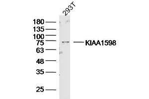 293T lysates probed with KIAA1598 Polyclonal Antibody, Unconjugated  at 1:300 dilution and 4˚C overnight incubation.