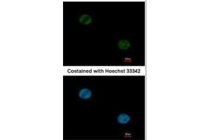 ICC/IF Image Immunofluorescence analysis of paraformaldehyde-fixed HeLa, using FOXA1, antibody at 1:1000 dilution.